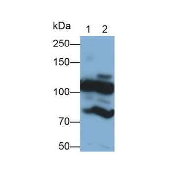 Complement Component 3a (C3a) Human Monoclonal Antibody