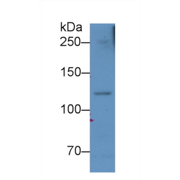 Complement Component 5a (C5a) Human Monoclonal Antibody