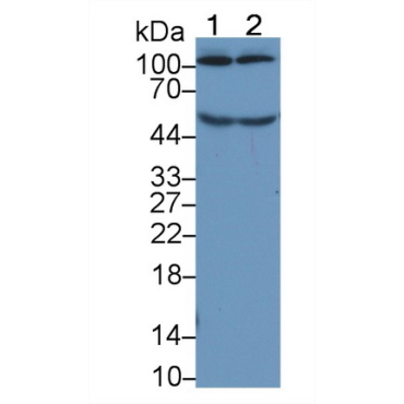 Complement Component 5a (C5a) Human Monoclonal Antibody