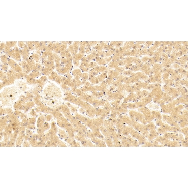 Complement Component 5a (C5a) Human Monoclonal Antibody