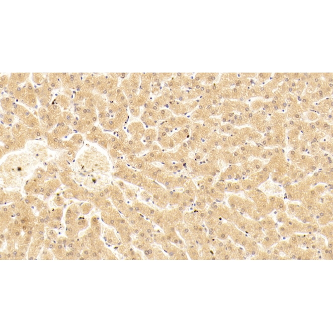 Complement Component 5a (C5a) Human Monoclonal Antibody