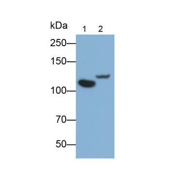 Complement Component 5a (C5a) Human Monoclonal Antibody