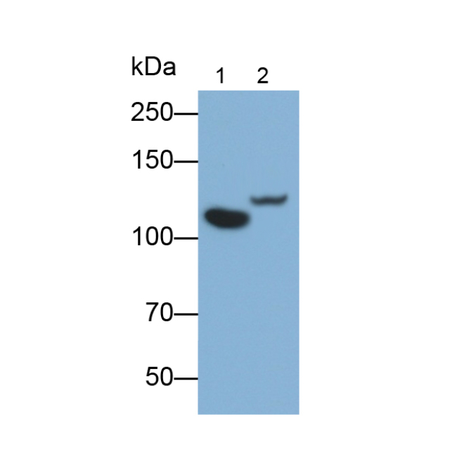 Complement Component 5a (C5a) Human Monoclonal Antibody