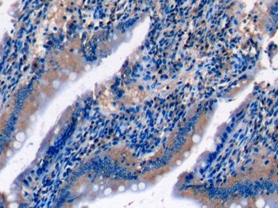 Complement Component 5a (C5a) Rat Monoclonal Antibody