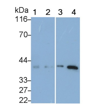 Follistatin (FS) Human Monoclonal Antibody