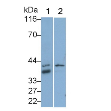 Follistatin (FS) Human Monoclonal Antibody