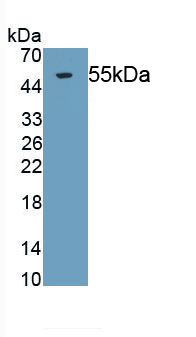 Tissue Factor Pathway Inhibitor (TFPI) Human Monoclonal Antibody