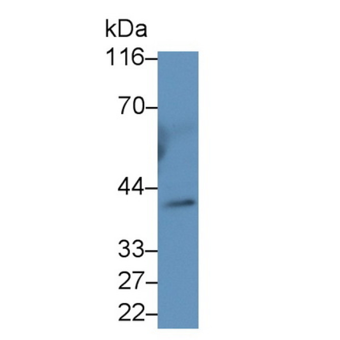 Inhibin Alpha (INHa) Human Monoclonal Antibody
