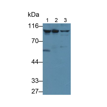 Inhibin Alpha (INHa) Human Monoclonal Antibody