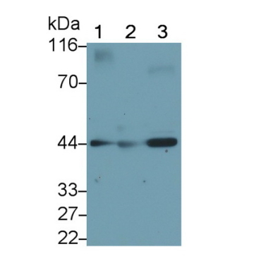 Sex Hormone Binding Globulin (SHBG) Human Monoclonal Antibody