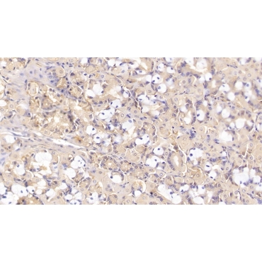 Sex Hormone Binding Globulin (SHBG) Human Monoclonal Antibody