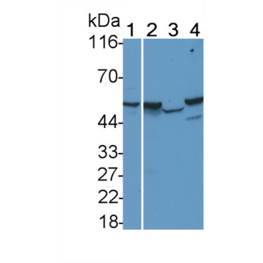Sex Hormone Binding Globulin (SHBG) Human Monoclonal Antibody