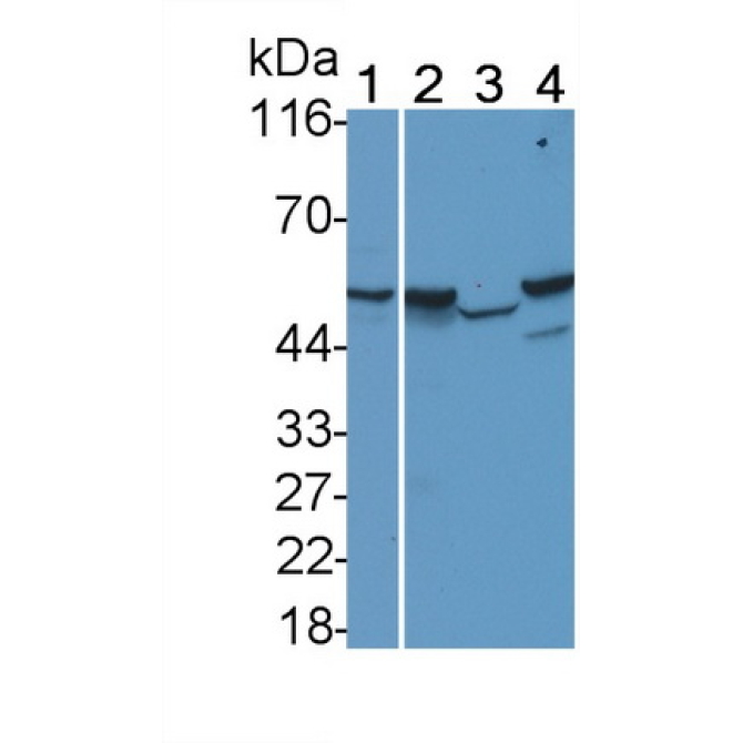 Sex Hormone Binding Globulin (SHBG) Human Monoclonal Antibody
