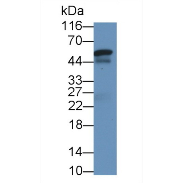 Sex Hormone Binding Globulin (SHBG) Human Monoclonal Antibody