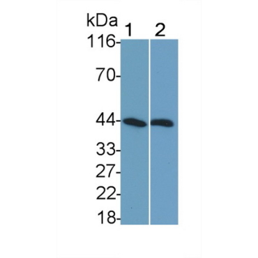 Sex Hormone Binding Globulin (SHBG) Human Monoclonal Antibody