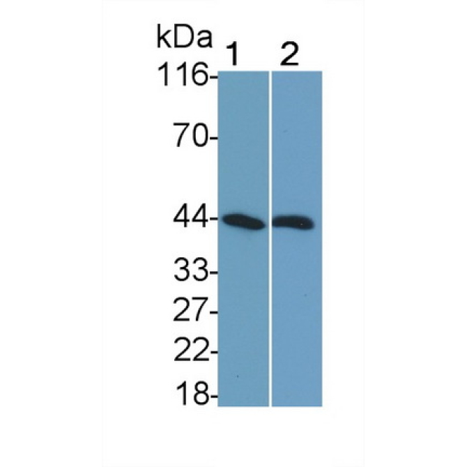 Sex Hormone Binding Globulin (SHBG) Human Monoclonal Antibody