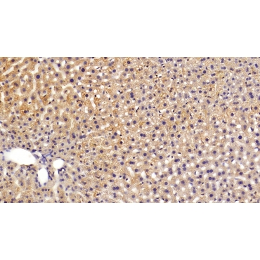 Sex Hormone Binding Globulin (SHBG) Mouse Monoclonal Antibody