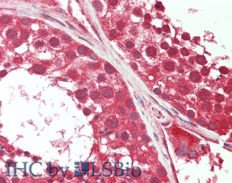 Dehydroepiandrosterone (DHEA) Pan-species (General) Monoclonal Antibody