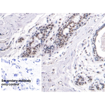 High Mobility Group Protein 1 (HMGB1) Human Monoclonal Antibody
