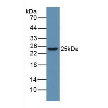 High Mobility Group Protein 1 (HMGB1) Human Monoclonal Antibody