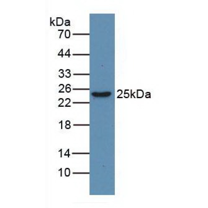 High Mobility Group Protein 1 (HMGB1) Human Monoclonal Antibody