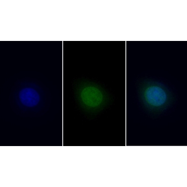 High Mobility Group Protein 1 (HMGB1) Human Monoclonal Antibody