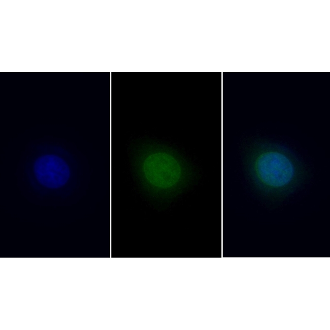 High Mobility Group Protein 1 (HMGB1) Human Monoclonal Antibody