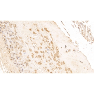 High Mobility Group Protein 1 (HMGB1) Human Monoclonal Antibody