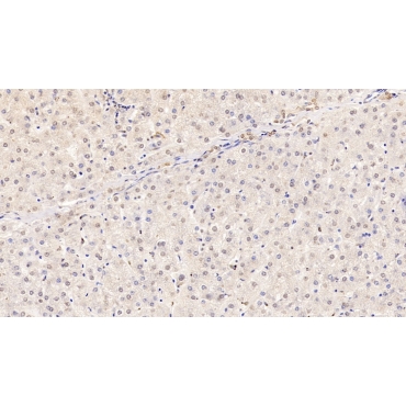 High Mobility Group Protein 1 (HMGB1) Human Monoclonal Antibody