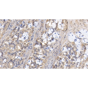 High Mobility Group Protein 1 (HMGB1) Human Monoclonal Antibody