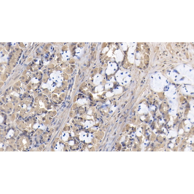 High Mobility Group Protein 1 (HMGB1) Human Monoclonal Antibody