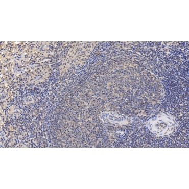 GATA Binding Protein 3 (GATA3) Human Monoclonal Antibody