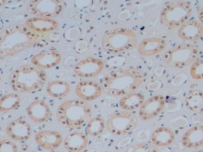 GATA Binding Protein 3 (GATA3) Human Monoclonal Antibody