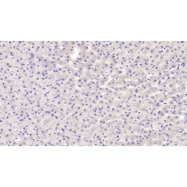 Alpha-Hemoglobin Stabilizing Protein (aHSP) Human Monoclonal Antibody