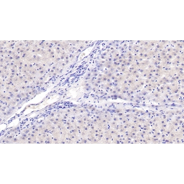 Alpha-Hemoglobin Stabilizing Protein (aHSP) Human Monoclonal Antibody