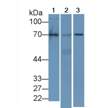 Early Growth Response Protein 1 (EGR1) Human Monoclonal Antibody
