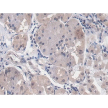 Early Growth Response Protein 1 (EGR1) Human Monoclonal Antibody