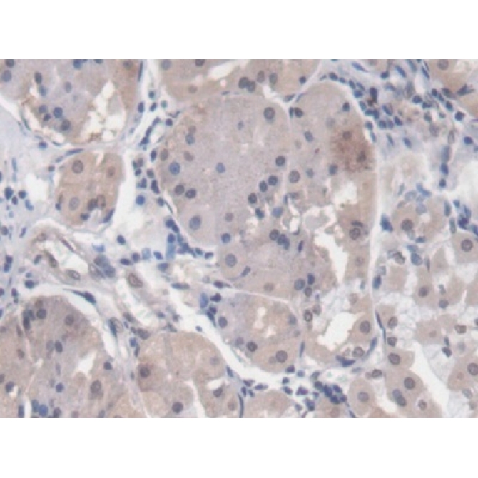 Early Growth Response Protein 1 (EGR1) Human Monoclonal Antibody
