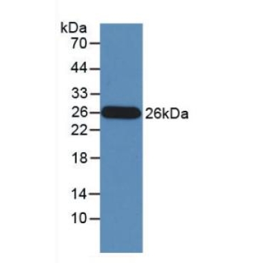 Granzyme M (GZMM) Human Monoclonal Antibody