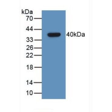 Growth Hormone Releasing Hormone (GHRH) Human Monoclonal Antibody