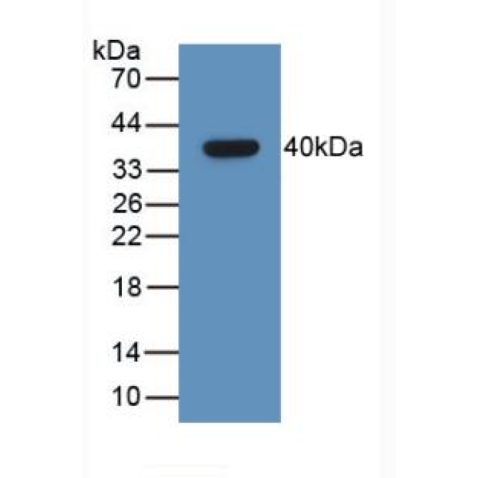 Growth Hormone Releasing Hormone (GHRH) Human Monoclonal Antibody