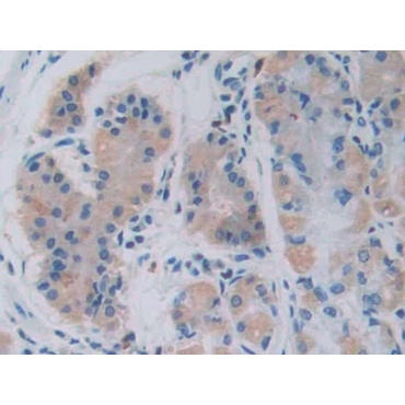 Growth Hormone Releasing Hormone (GHRH) Human Monoclonal Antibody