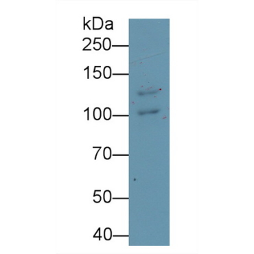 Desmoglein 3 (DSG3) Human Monoclonal Antibody