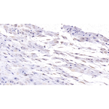 Desmoglein 3 (DSG3) Human Monoclonal Antibody