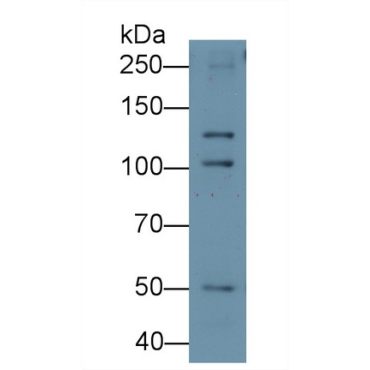 Desmoglein 3 (DSG3) Human Monoclonal Antibody