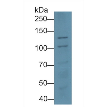 Desmoglein 3 (DSG3) Human Monoclonal Antibody