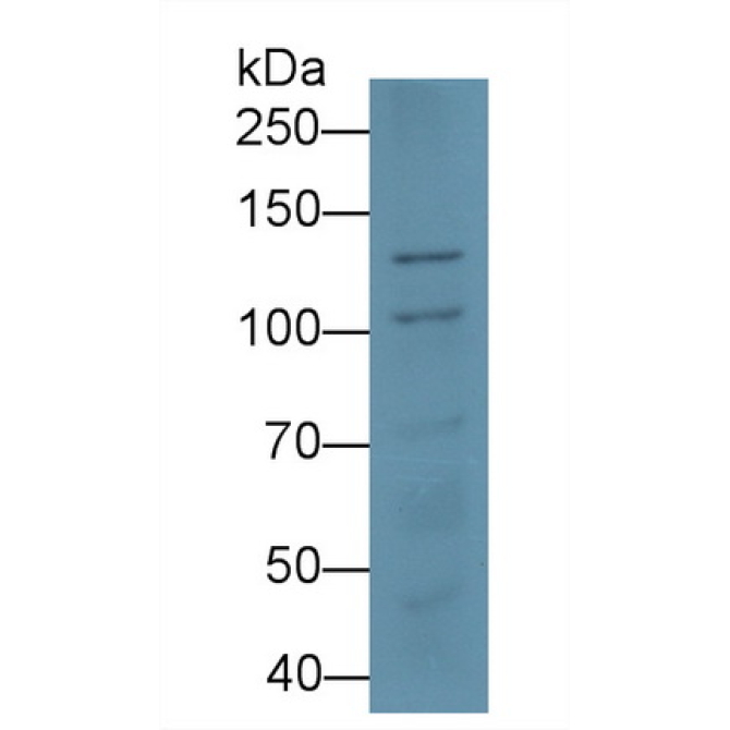 Desmoglein 3 (DSG3) Human Monoclonal Antibody