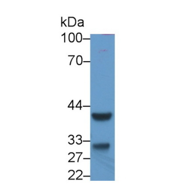 Inhibin Beta C (INHbC) Human Monoclonal Antibody
