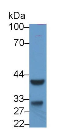 Inhibin Beta C (INHbC) Human Monoclonal Antibody
