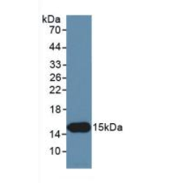 Inhibin Beta C (INHbC) Human Monoclonal Antibody
